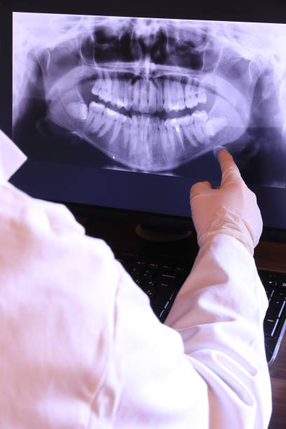 Best Emergency Dentist for Knocked-Out Tooth in Bellwood, VA