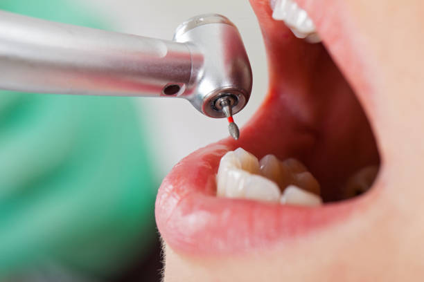 Best Pediatric Emergency Dentist in Bellwood, VA